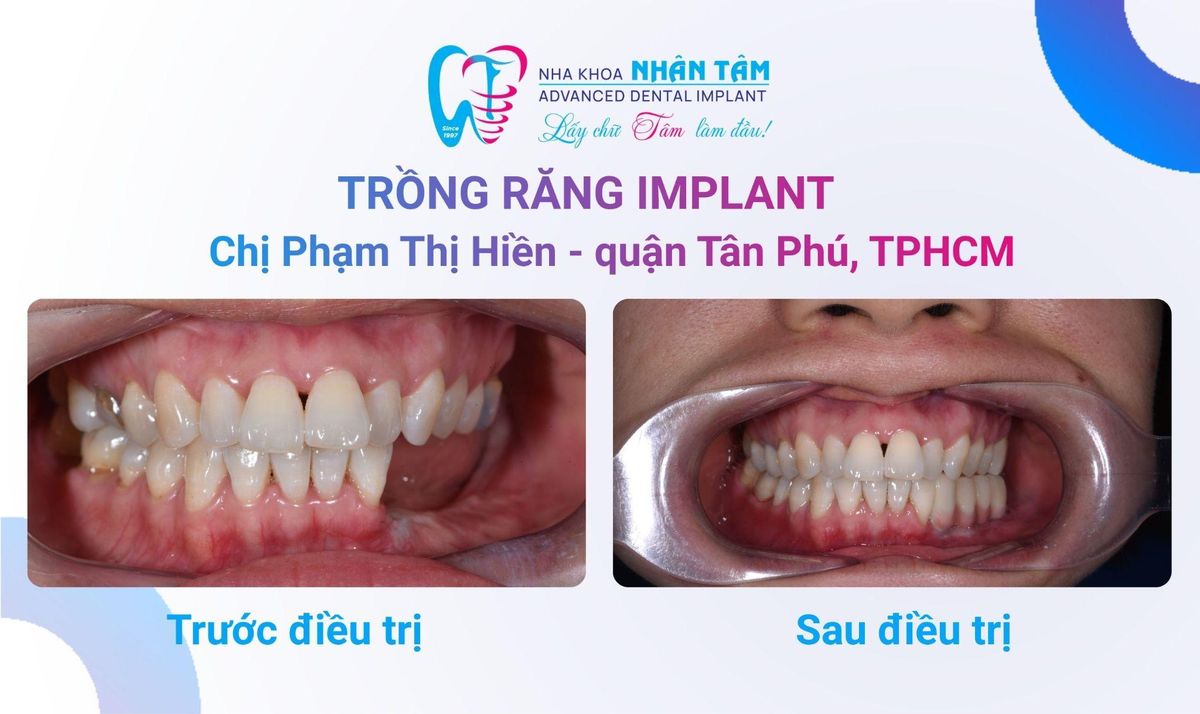 Chị Phạm Thị Hiền (Quận Tân Phú, TPHCM) Hình: Chị Phạm Thị Hiền (Quận Tân Phú, TPHCM)