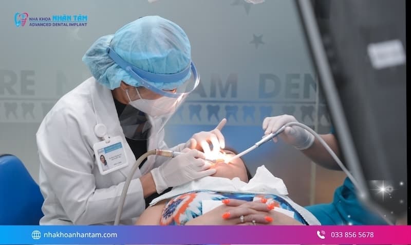 trám răng bằng composite