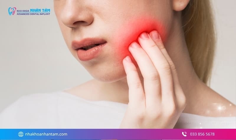 trám răng có bền không