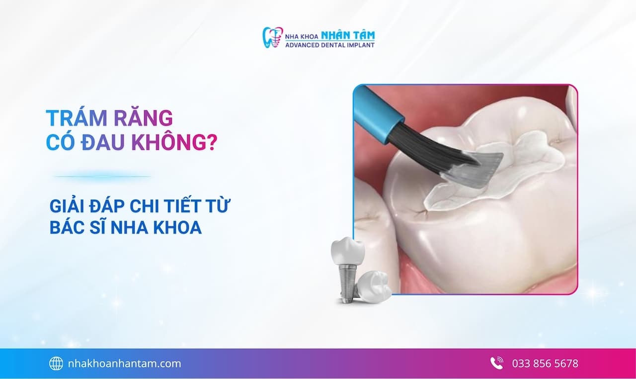 Trám răng có đau không? Giải đáp chi tiết từ bác sĩ nha khoa Hình: Trám răng có đau không? Giải đáp chi tiết từ bác sĩ nha khoa