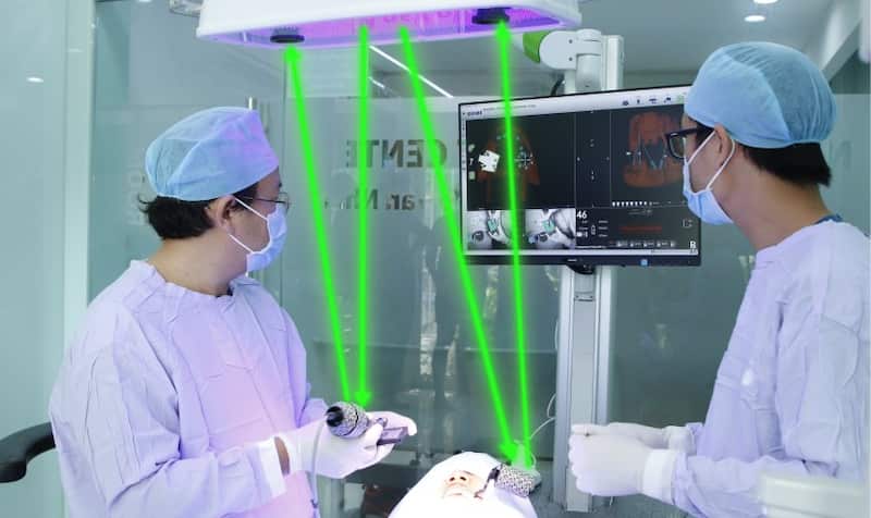 trồng răng implant mất bao lâu