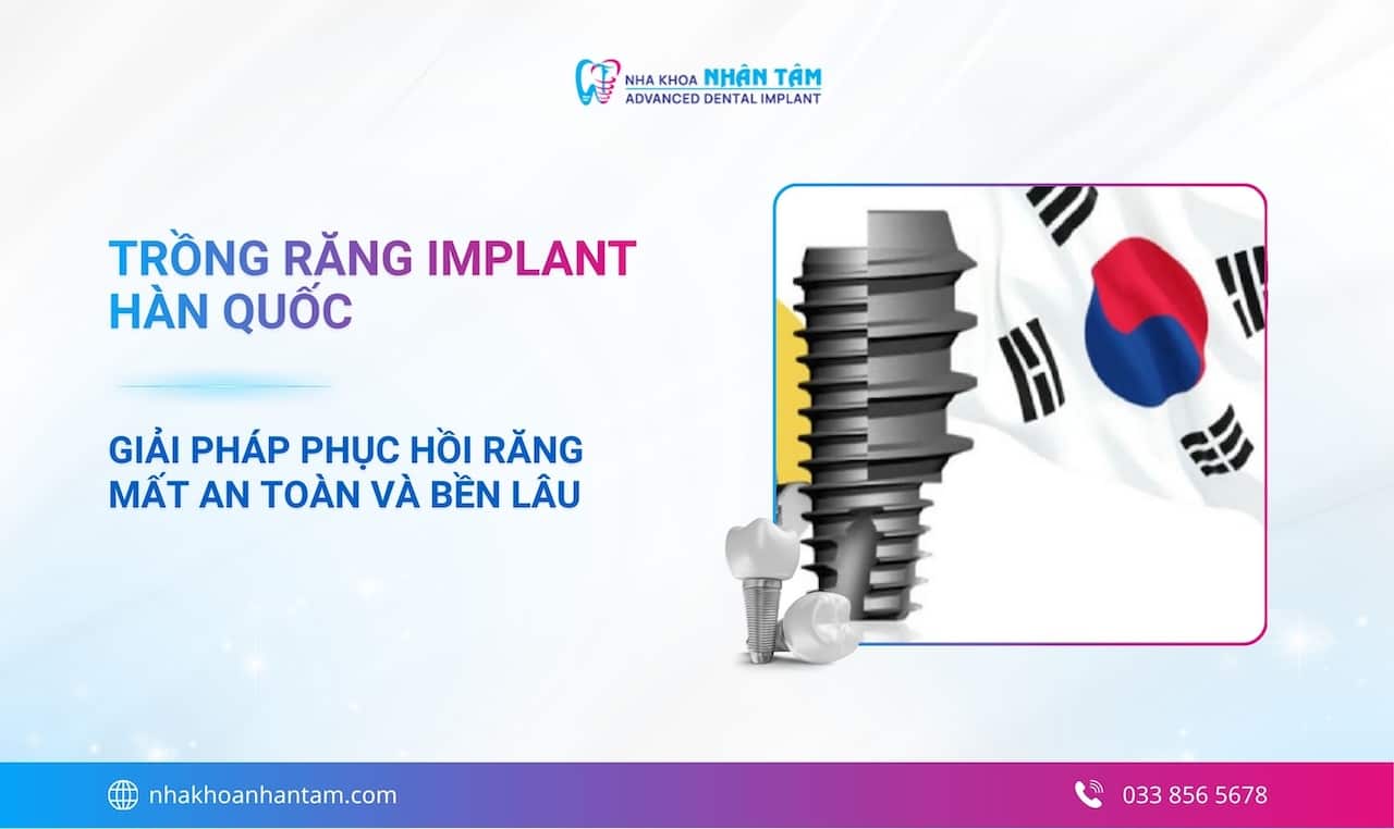 Trồng răng implant Hàn Quốc - Giải pháp phục hồi răng mất an toàn và bền lâu