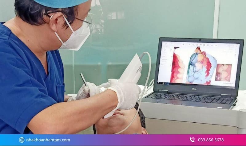 trồng răng implant mất thời gian bao lâu