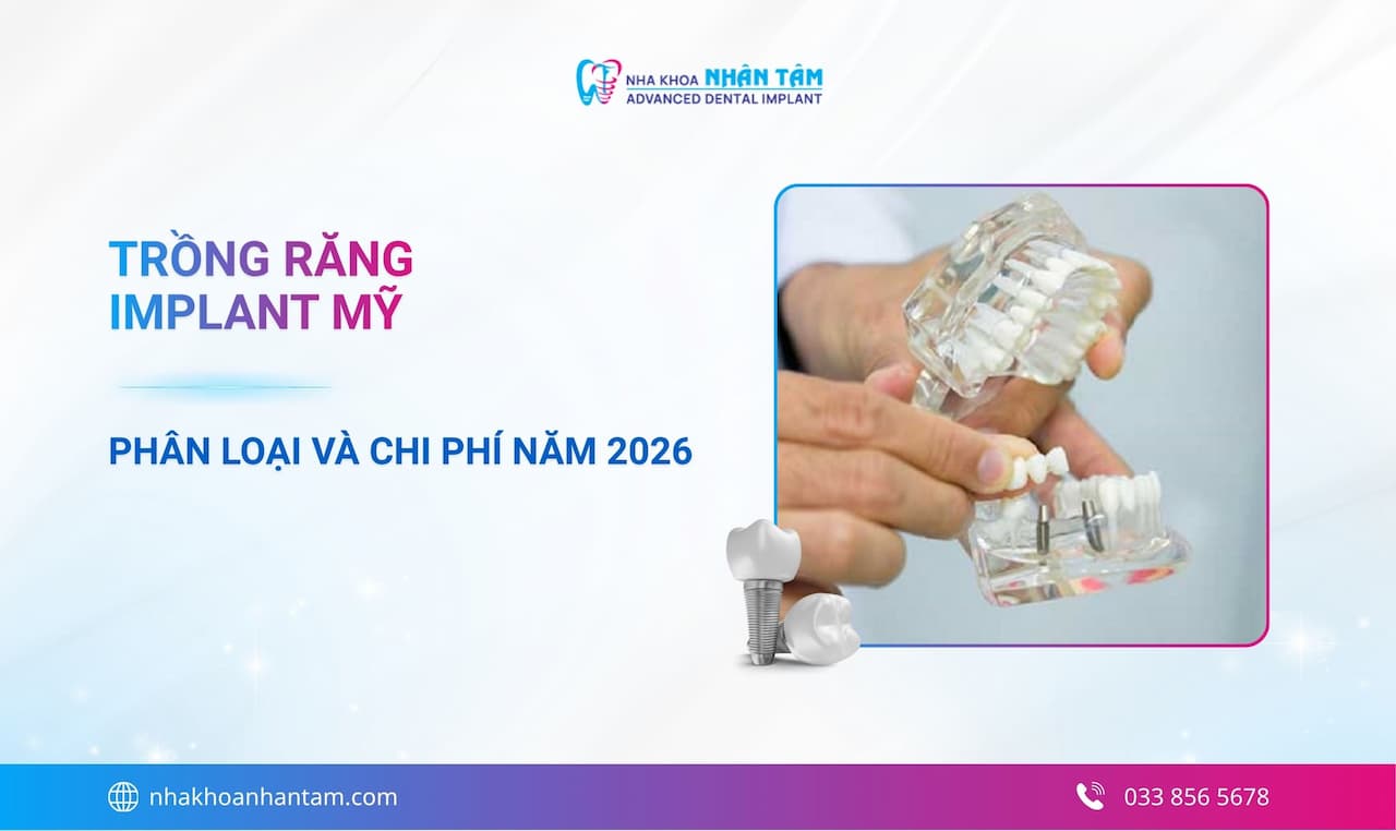 Hình: Trồng răng Implant Mỹ là gì? Có tốt không? Phân loại và chi phí năm 2026