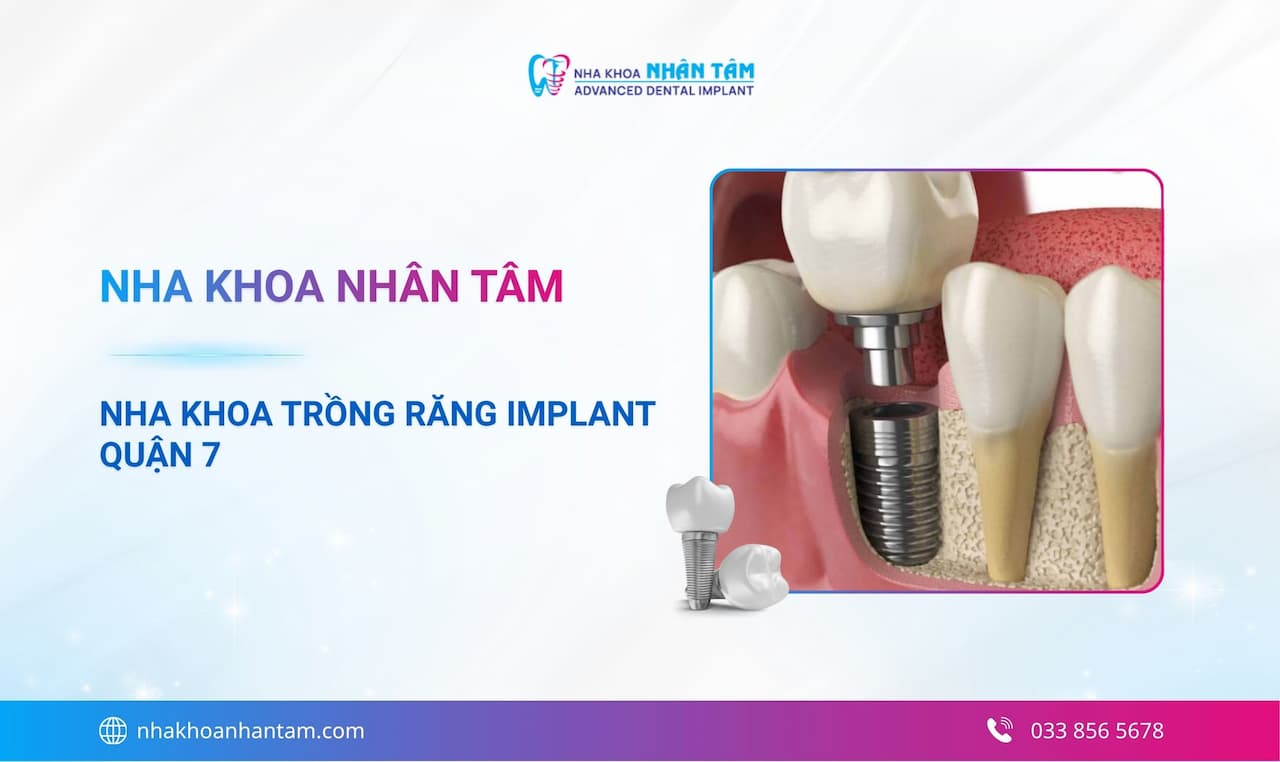 Hình: Nha khoa trồng răng Implant Quận 7 – Nha khoa Nhân Tâm