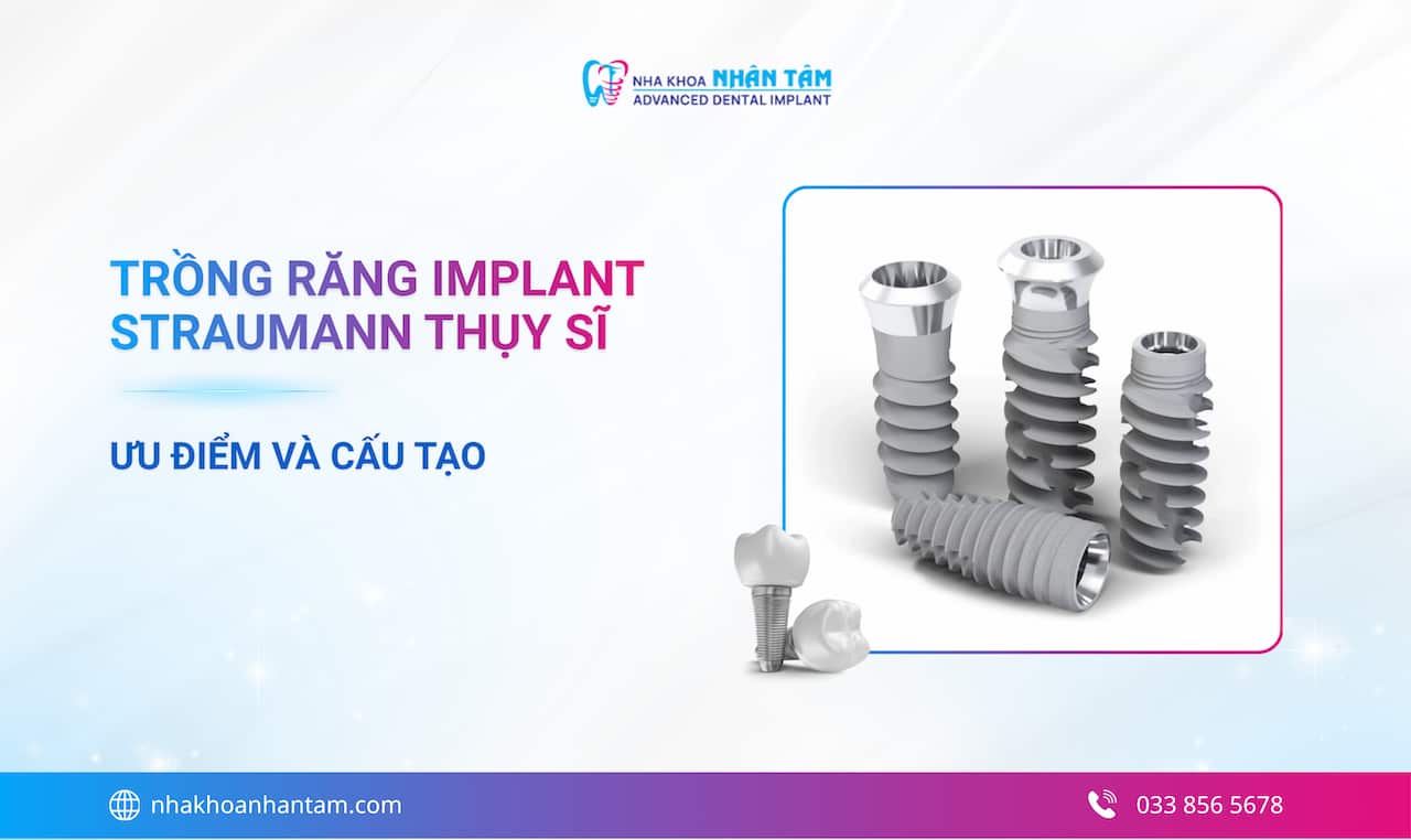 Trồng Răng Implant Straumann Thụy Sĩ: Đánh Giá, Bảng Giá & Ưu Điểm (Cập nhật 2026)