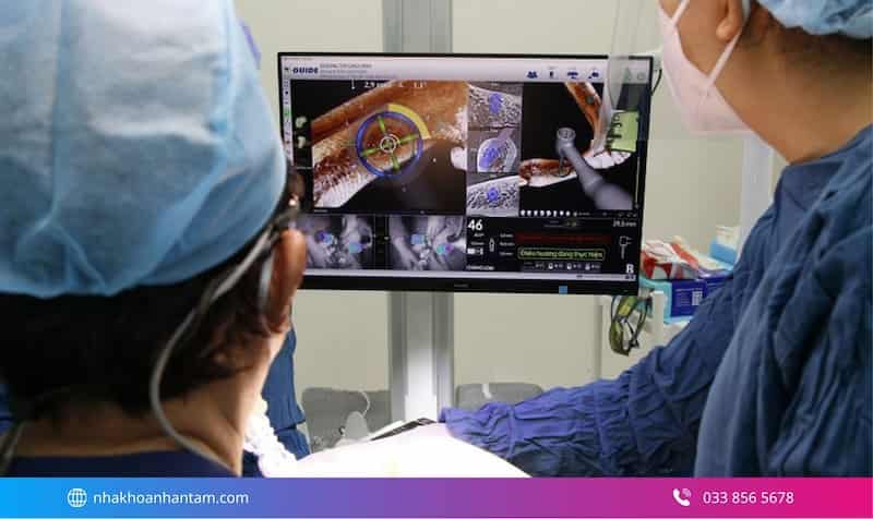 trồng răng implant toàn hàm giá bao nhiêu