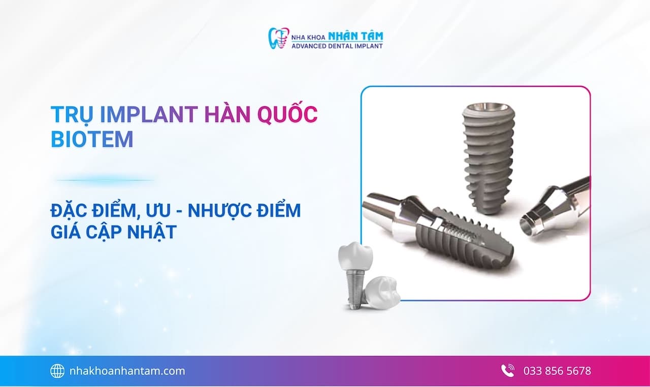 Hình: Trụ Implant Hàn Quốc Biotem: Đặc điểm, ưu - nhược điểm và giá cập nhật