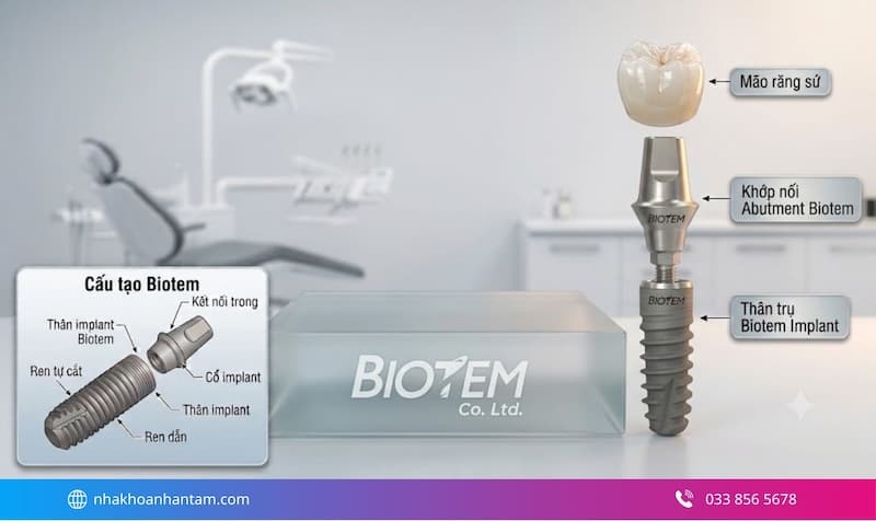 ưu điểm trụ implant biotem