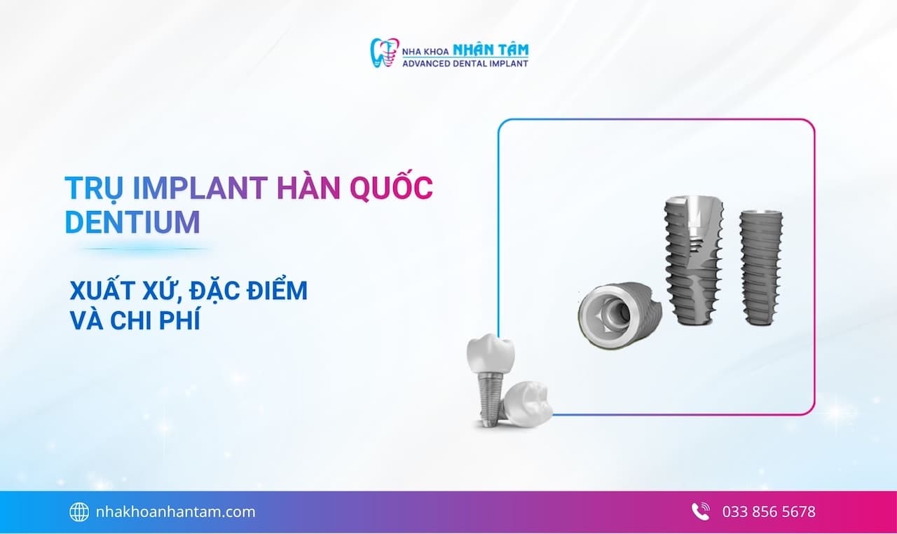 Trụ implant Hàn Quốc Dentium: Đặc điểm, ưu nhược điểm và chi phí