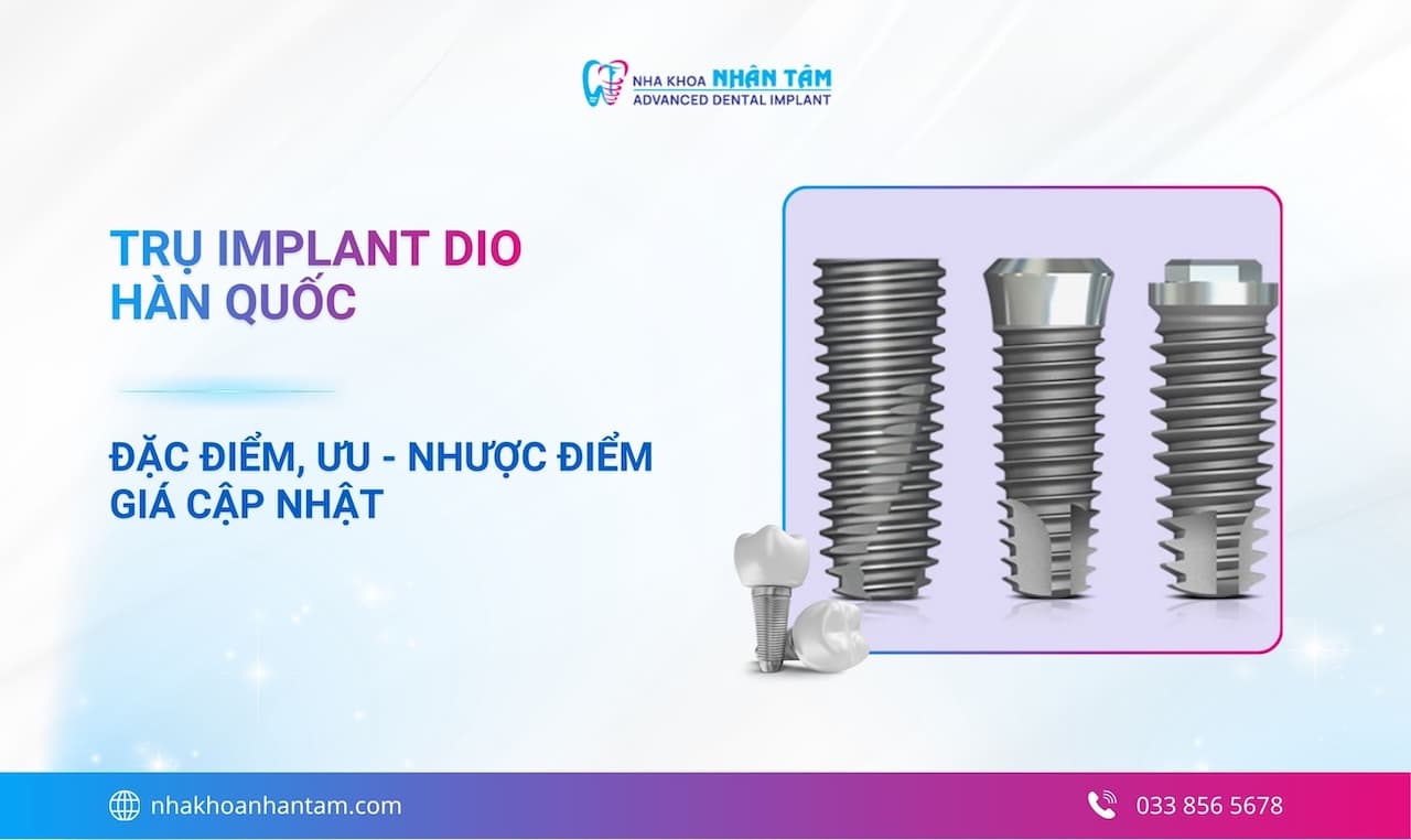 Hình: Trụ Implant Dio Hàn Quốc: Đặc điểm, ưu nhược điểm và giá cập nhật