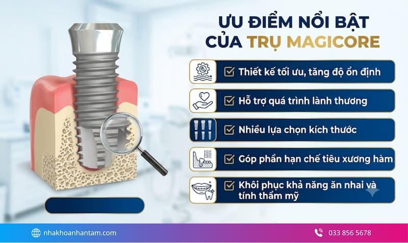 Hình: đánh giá ưu điểm trụ implant MagiCore