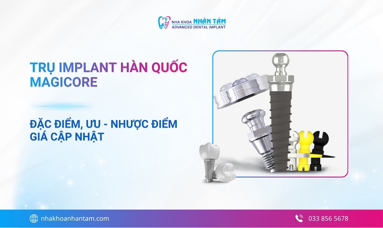 Hình: Trụ Implant Hàn Quốc MagiCore: Đặc điểm, ưu - nhược điểm và giá cập nhật