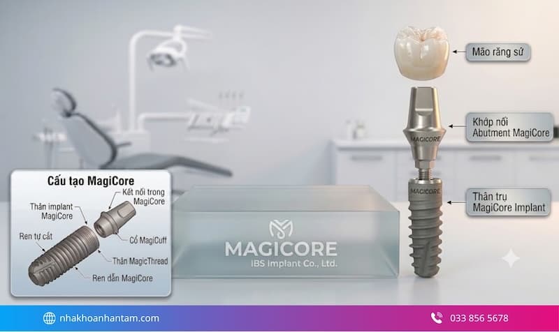Hình: ưu điểm trụ implant MagiCore