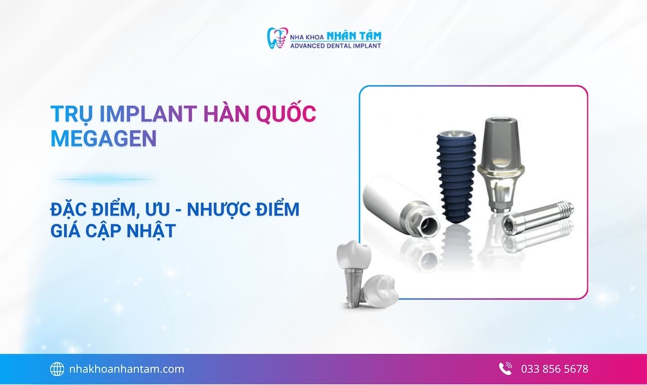 Hình: Trụ Implant Hàn Quốc Megagen: Đặc điểm, ưu - nhược điểm và giá cập nhật