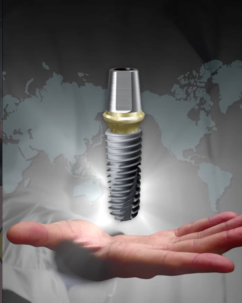 Hình: trụ implant Osstem có khả năng tích hợp xương ổn định