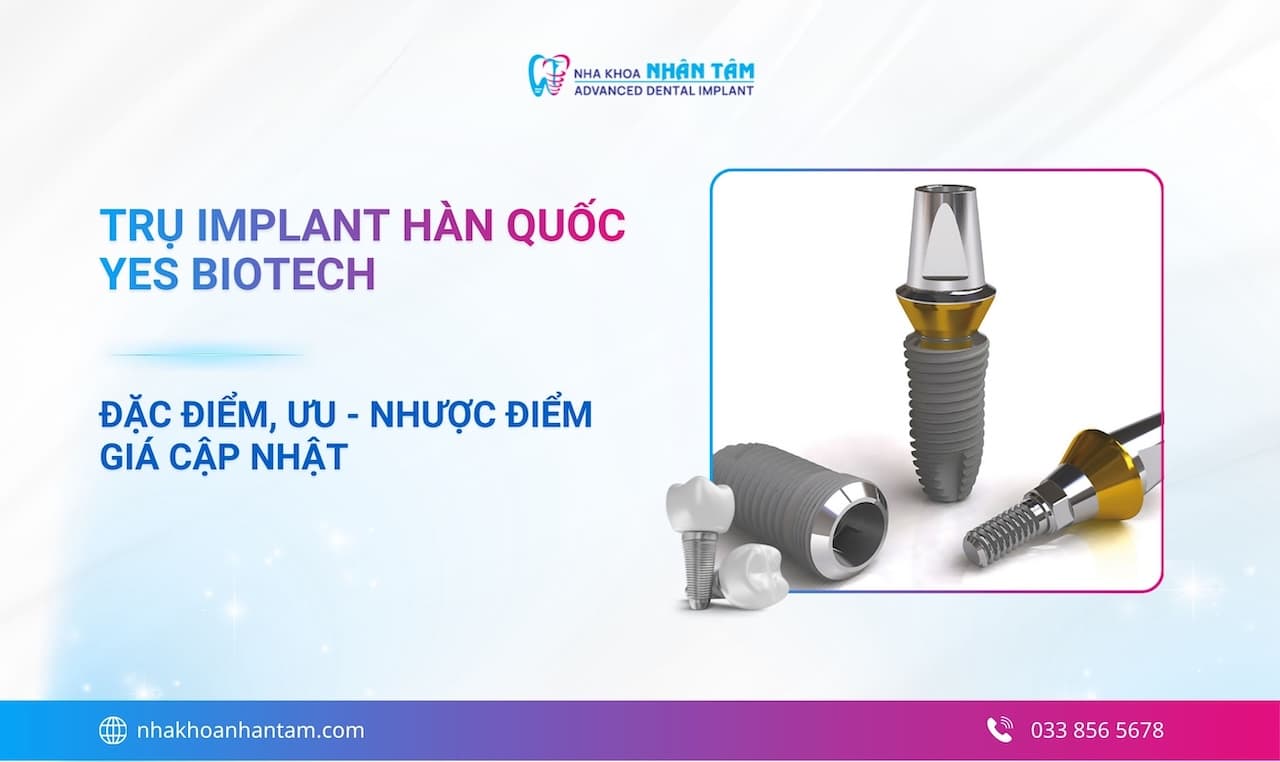 Hình: Trụ Implant Hàn Quốc Yes Biotech: Đặc điểm, ưu  nhược điểm và giá cập nhật