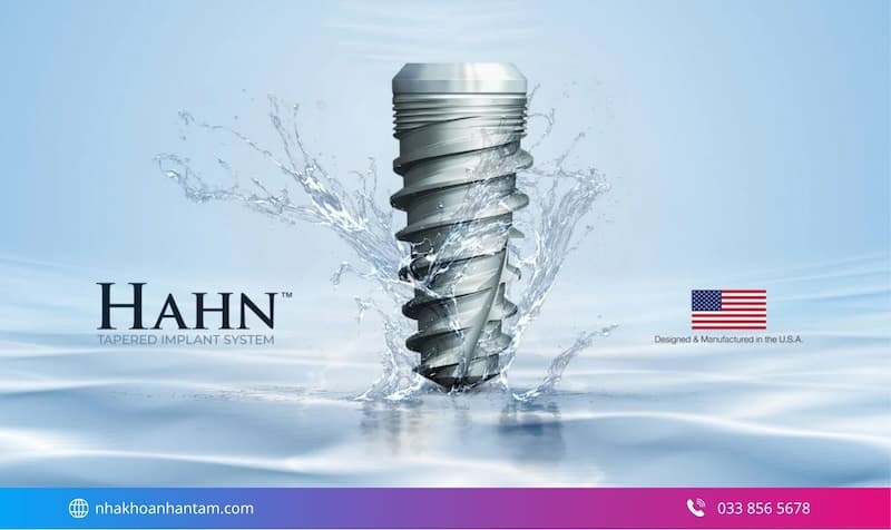 trụ implant mỹ có tốt không