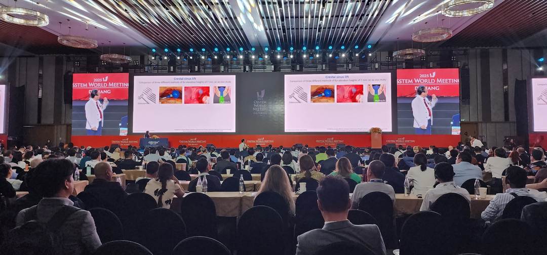 Hình: Tiến sĩ, Bác sĩ Võ Văn Nhân tham gia Hội nghị Osstem World Meeting 2025 với chủ đề “Nâng xoang an toàn bằng Core drill và kỹ thuật số trong cấy ghép implant”