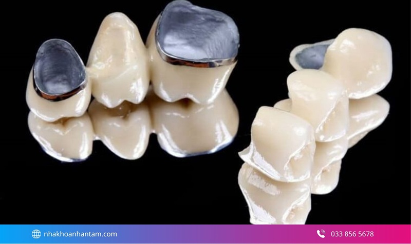 ưu điểm bọc răng sứ