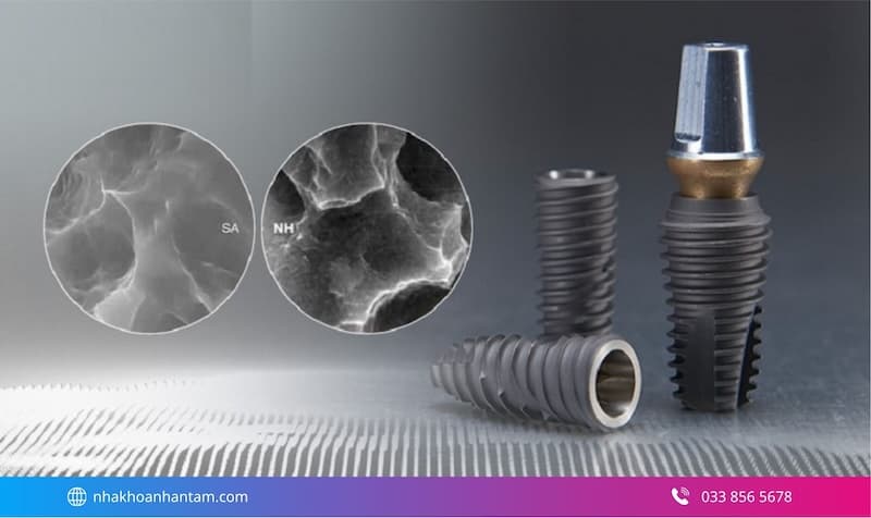 ưu điểm implant mỹ
