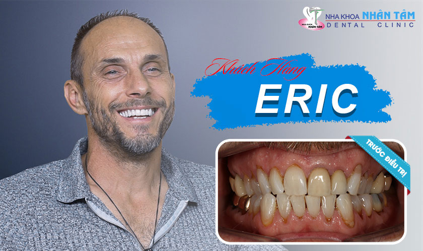 Sứ mệnh của nha khoa Nhân Tâm