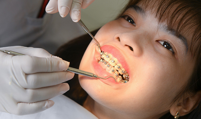 Bác sĩ niềng răng có vai trò quan trọng đến kết quả niềng răng