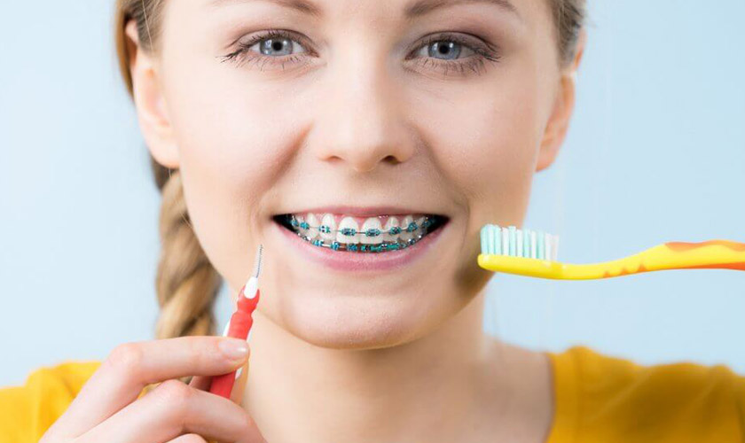 Niềng răng mắc cài không được đánh giá cao về thẩm mỹ