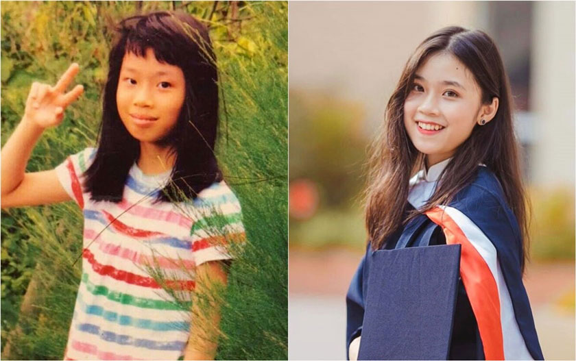 Dậy thì thành công sau khi niềng răng