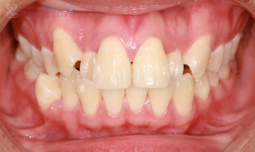 tiêu chí lựa chọn địa chỉ niềng răng uy tín