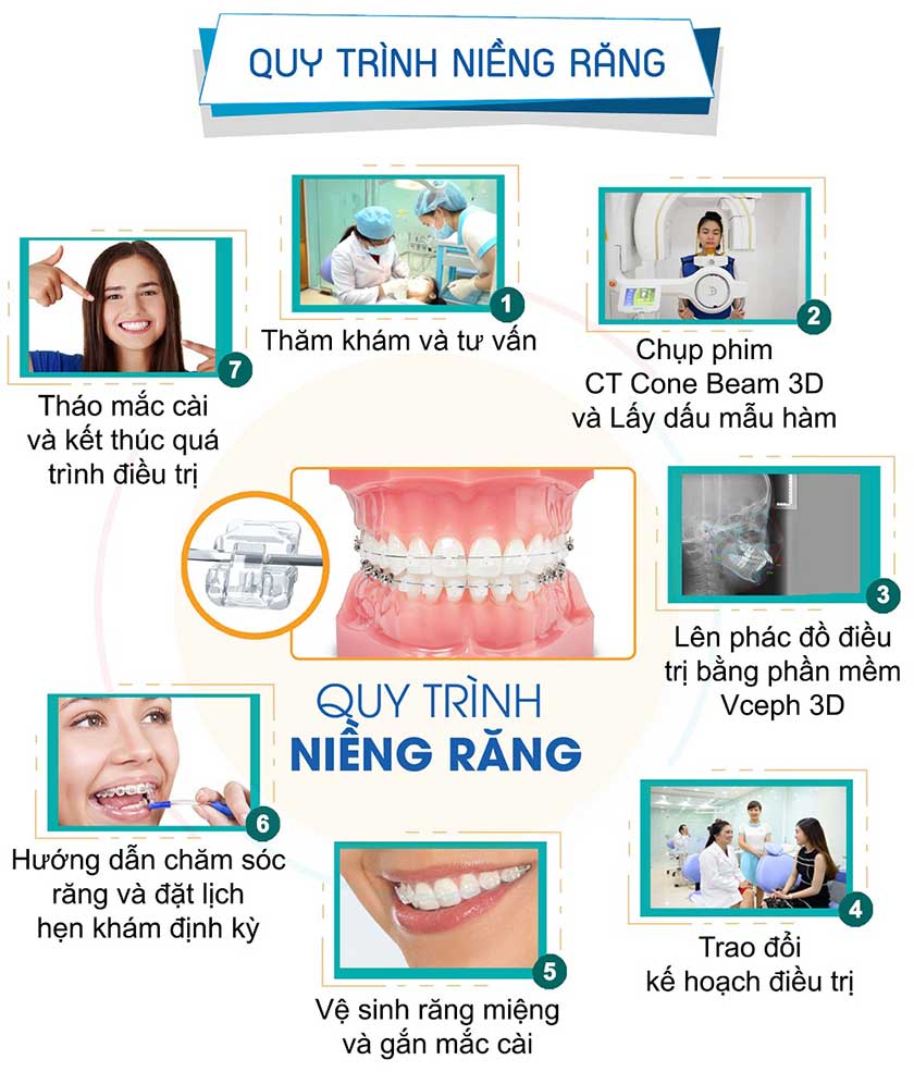 Niềng răng – Giải pháp làm đẹp răng số 1 hiện nay