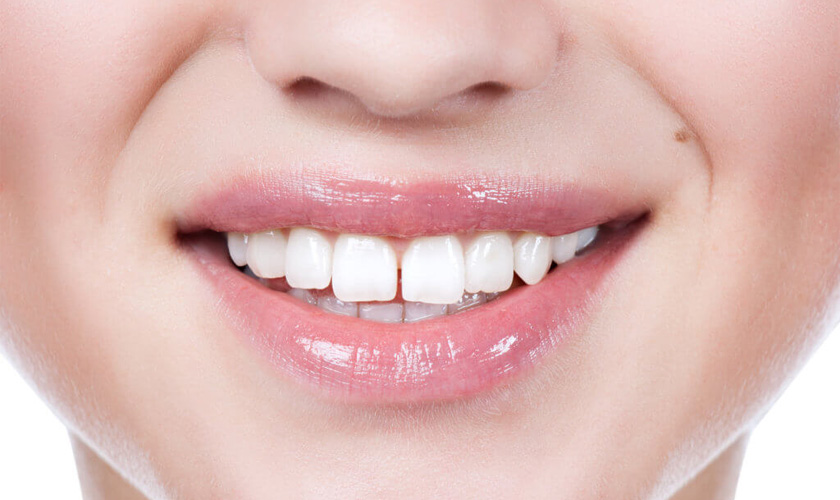 Invisalign có chỉ định rất tốt với các trường hợp răng thưa, do khay niềng ôm trọn bề mặt răng và di chuyển rất chính xác