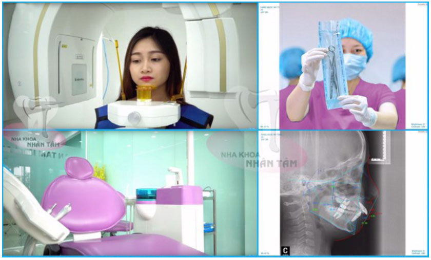 Nha khoa Nhân Tâm - Trung tâm niềng răng uy tín