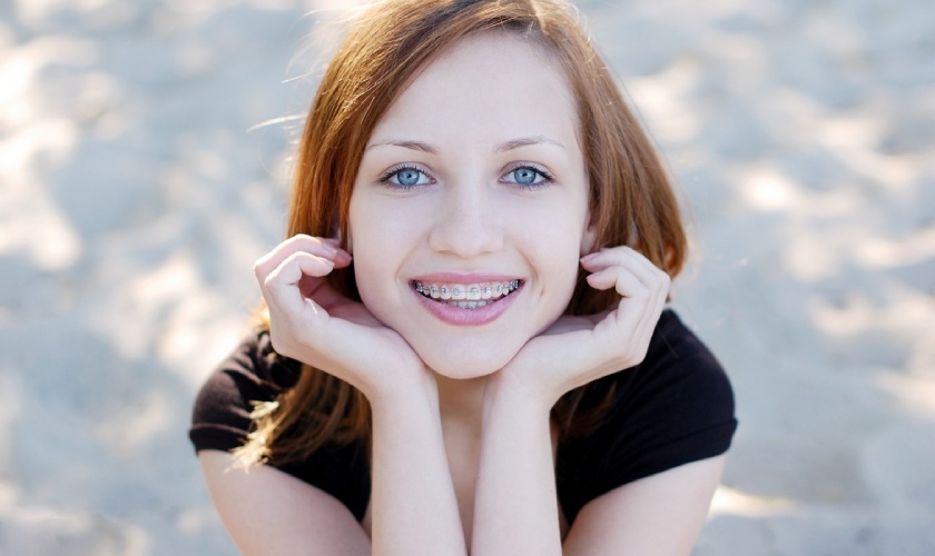 Niềng răng trước và sau thay đổi như thế nào?