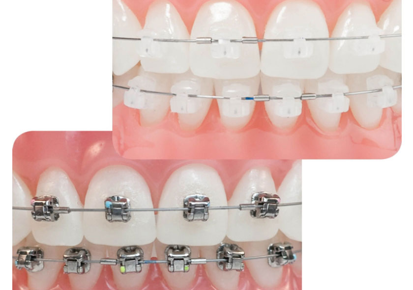 Kết quả và phương pháp có thể thay đổi