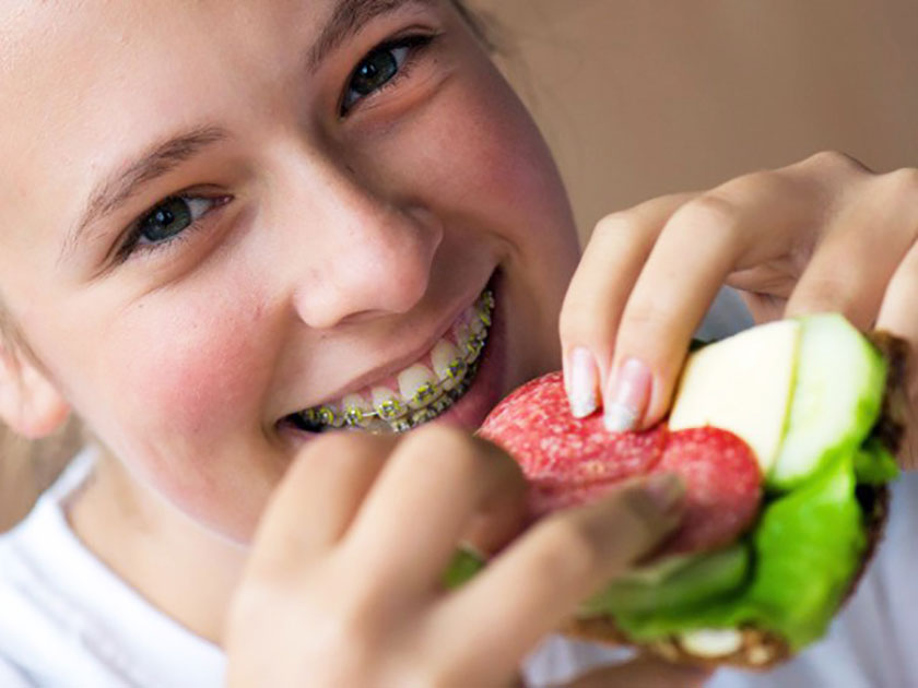 Răng bọc sứ rồi có thể niềng được không?