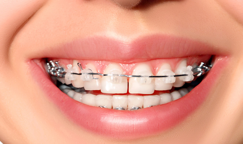 Kết quả và phương pháp có thể thay đổi tùy theo thể trạng mỗi người