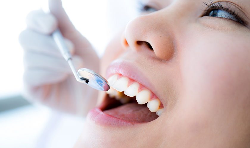 Cần thăm khám nha khoa để thực hiện cạo vôi răng