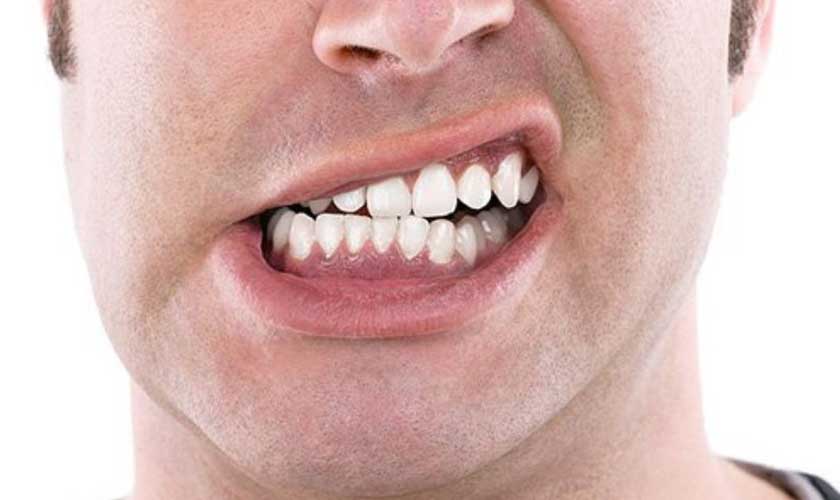 Tật nghiến răng gây tổn thương tủy răng