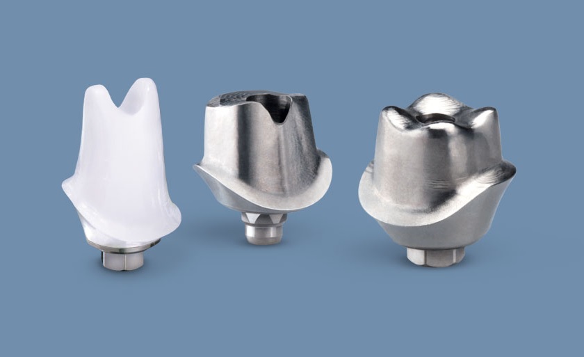 Khớp nối (Abutment)