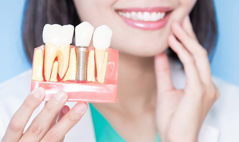 Implant là giải pháp tối ưu để phục hồi răng mất