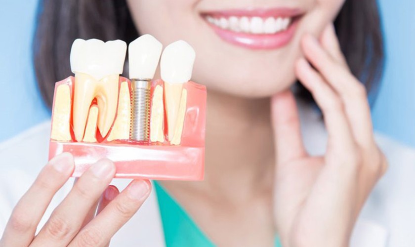 Phục hình Implant không gây nhiều đau đớn