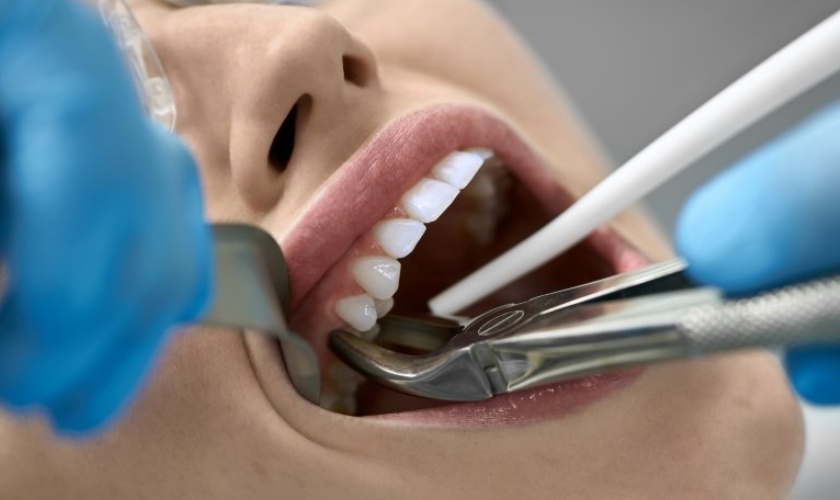 Bạn hoàn toàn có thể làm răng Implant sau khi vừa nhổ răng