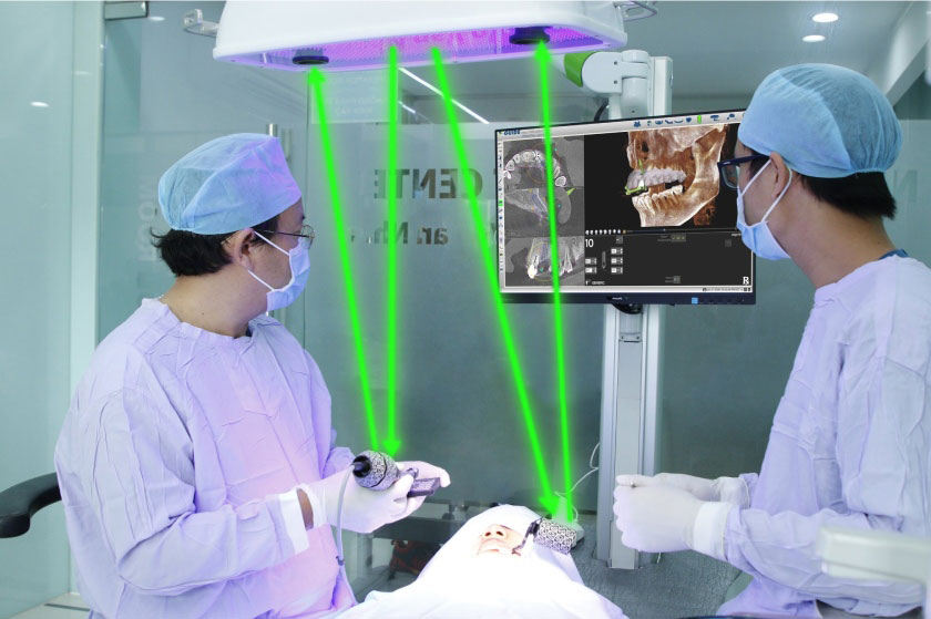 Chụp phim X-quang CT Cone Beam 3D