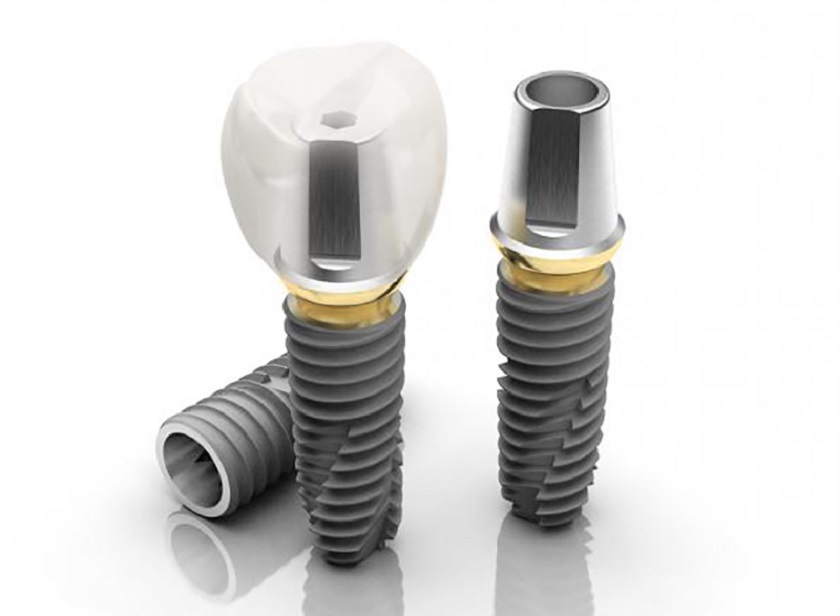 Chất liệu Titanium có tính tương thích sinh học cao