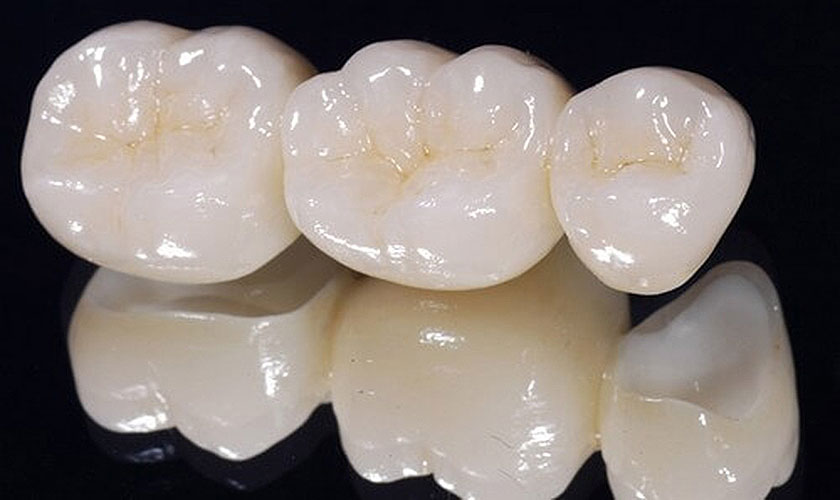 Để biết nên chọn răng sứ Cercon hay Zirconia, bạn cần được các thăm khám và tư vấn