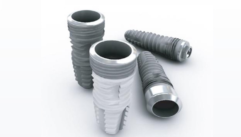 Các loại trụ Implant sẽ có mức giá khác nhau Các loại trụ Implant sẽ có mức giá khác nhau