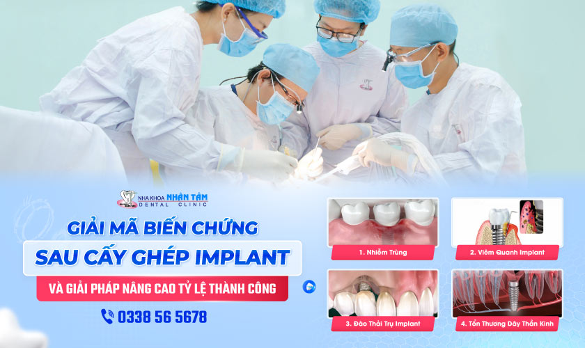 Hình: Giải mã biến chứng Implant & giải pháp tăng tỷ lệ thành công