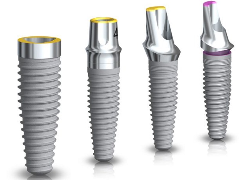 Mỗi loại trụ Implant sẽ có một mức giá khác nhau