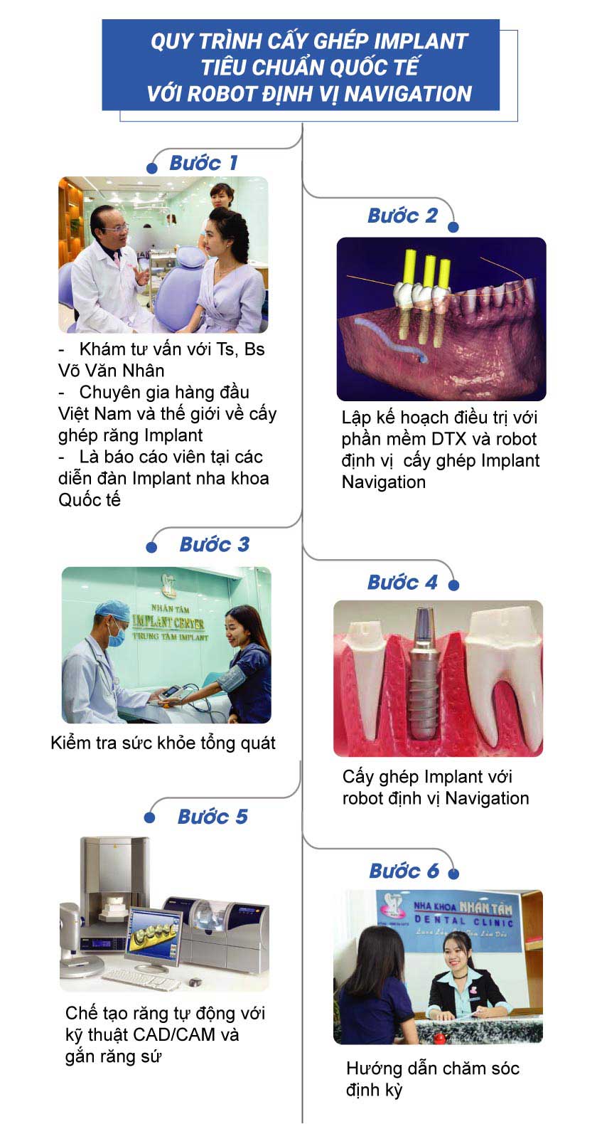 Quy trình cấy ghép răng Implant